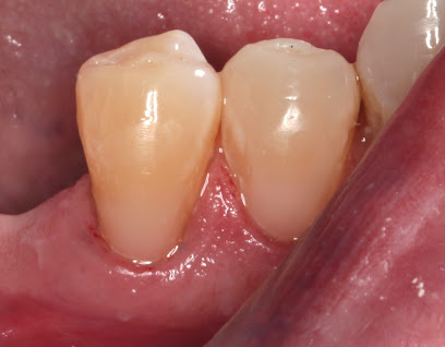 Cen-Tex Dental / Custom Smile Designs image