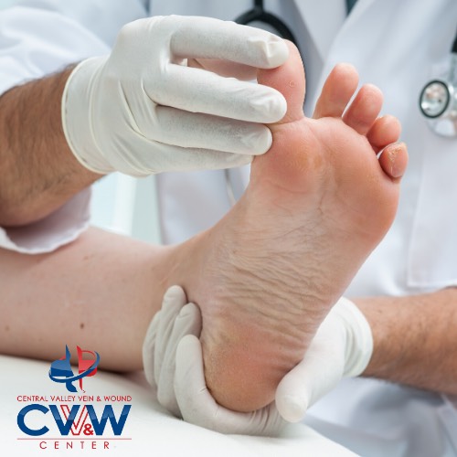 Central Valley Vein and Wound Center image