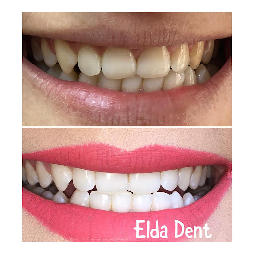 Elda Dent - Klinike Dentare image